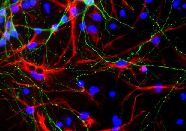Ringiovanite le cellule progenitrici dei neuroni del cervello (fonte: Gotoh laboratory of molecular biology CC-BY) © Ansa