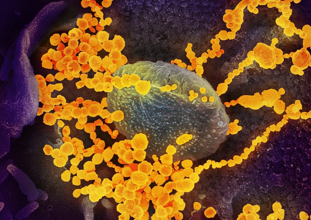 Particelle del virus SarsCoV2 sulla superficie di una cellula, viste al microscopio elettronico (fonte: NIAID) © Ansa