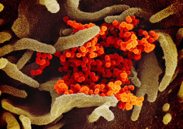 Una delle immagini del coronavirus SarsCov2 ottenute dal Niaid con il microscopio elettronico. le particelle virali sono colorate in arancio (fonte: NIAID-RML) © Ansa