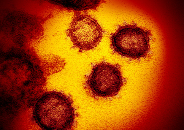 Dettaglio delle particelle del coronavirus SarsCov2 ottenute dal Niaid. Evidenti le protuberanze che danno l'impressione di una corona (fonte: NIAID-RML) © Ansa