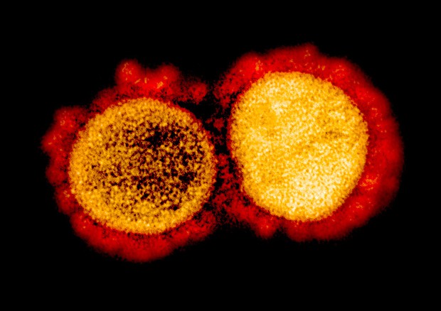 Particelle di coronavirus (fonte: NIAID) © Ansa