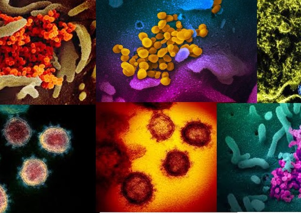 Immagini del coronavirus SarsCov2 ottenute dal Niaid con il microscopio elettronico (fonte: NIAID-RML)  © Ansa