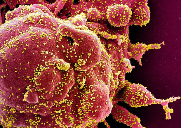 In giallo le particelle del coronavirus SarsCoV2 (fonte: NIAID) © Ansa