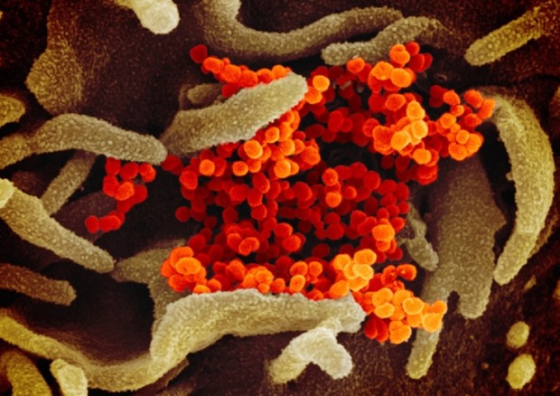 In arancione le particelle virali di SarsCoV2 che emergono da cellule coltivate in laboratorio (fonte: NIAID-RML)  © Ansa