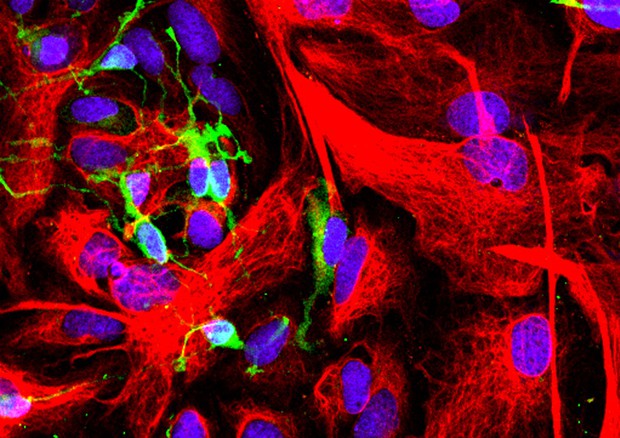 In verde le cellule progenitrici degli oligodendrociti (fonte: Oleg Tsupykov, CC BY-SA 4.0) © Ansa
