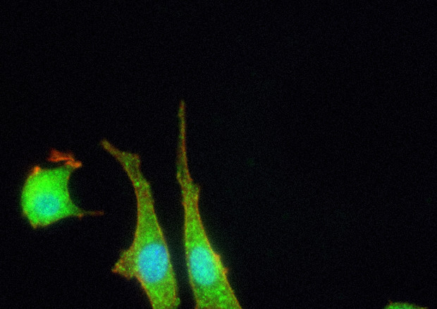 Esempio di cellule nervose ibride, in parte biologuche e in parte elettroniche (fonte: Stanford University, IIT) © Ansa