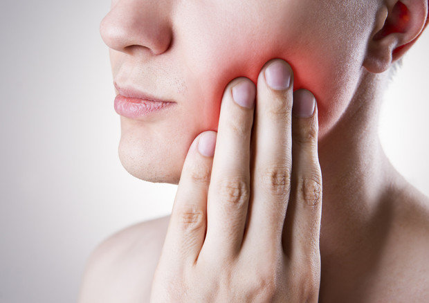 La parodontite potrebbe aggravare la sindrome del colon irritabile © Ansa