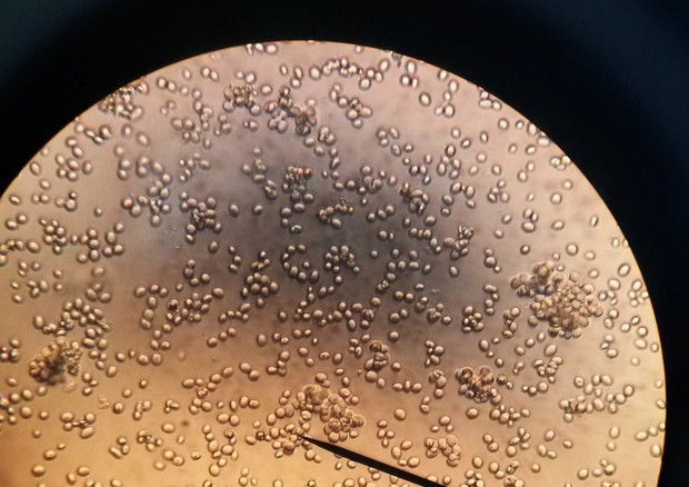 Cellule di lievito viste al miscroscopio (fonte: Sam LaRussa, Flickr) © Ansa