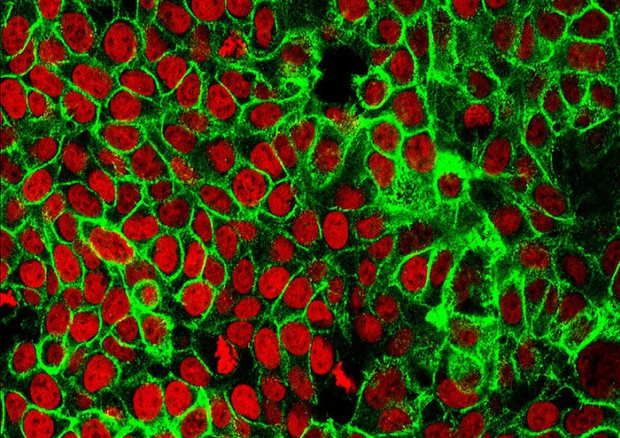 Cellule del tumore del colon (fonte: NCI Center for Cancer Research) © Ansa