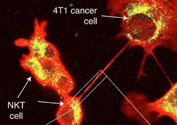 Una cellula tumorale (in alto a destra) allunga un tantacolo verso una cellula immunitaria (fonte: Saha, T. et al., Nat. Nanotechnol. (2021). https://doi.org/10.1038/s41565-021-01000-4) © Ansa
