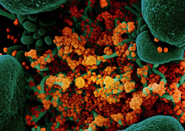 In arancione le particelle del virus SarsCoV2 (fonte: NIAID) © Ansa