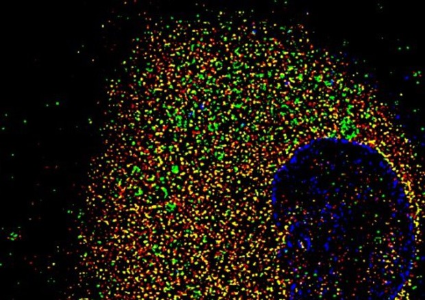 Cellula umana epiteliale nasale infettata con la variante Alfa del virus SarsCoV2 per 72 ore (fonte: CEINGE-Biotecnologie avanzate) © Ansa