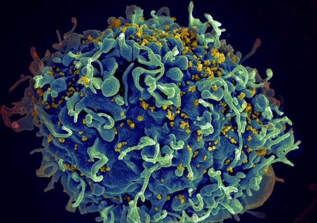 Un linfocita T attaccato dal virus HIV, evidenziato in giallo (fonte: S. Pincus, E. Fischer, A. Athman, National Institute of Allergy and Infectious Diseases/NIH) © Ansa