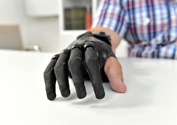 Protesi bionica ridà mano a 18enne, può usare touch screen © ANSA