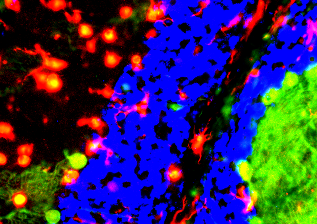 Cellule della microglia di topo (fonte: NICHD/A. Cougnoux, F.D. Porter) © Ansa