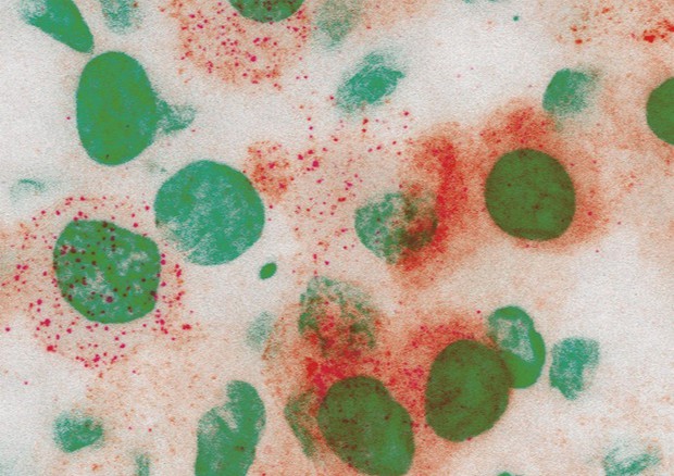 In rosso la proteina Spike con cui il virus attacca le cellule dell’epitelio bronchiale (fonte: Humanitas) © Ansa