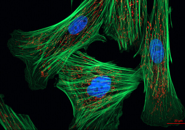 Fibroblasti, cellule progenitrici della pelle (fonte: Zeiss Microscopy) © Ansa