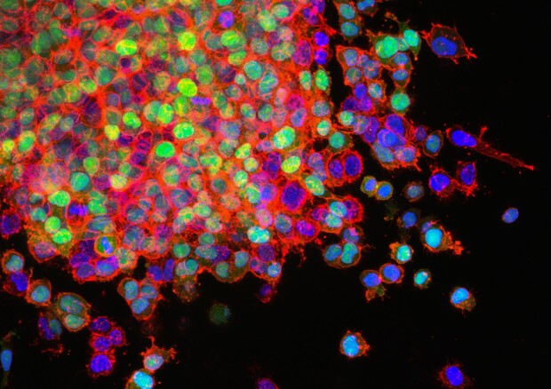 La mappa genetica dei tumori getta nuova luce su come nasconoe cambiano nel tempo le cellule malate (fonte: National Cancer Institute via unsplash) © Ansa