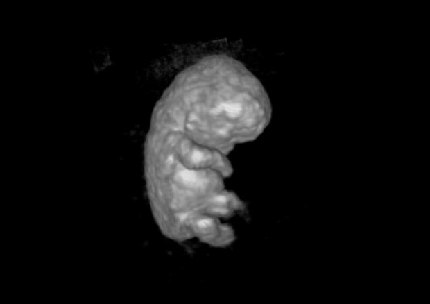 L'ologramma di un embrione nell'utero, a 8 settimane (fonte: Carsten Pietersma, Erasmus) © Ansa