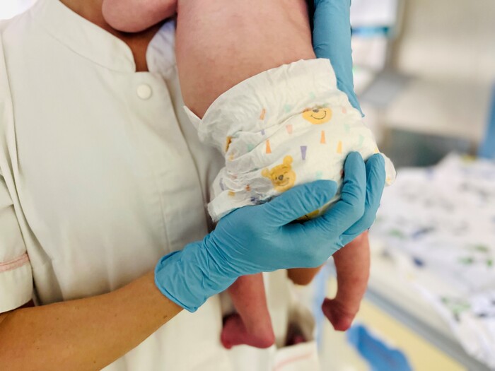 A photo of the diaper to discover some disorders of newborns - The ...