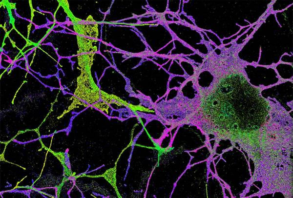 Neuroni dell’ippocampo di topo (fonte: Hazen Babcock, Melike Lakadamyali, Jeff Lichtman, Xiaowei Zhuang, Harvard University, HHMI)