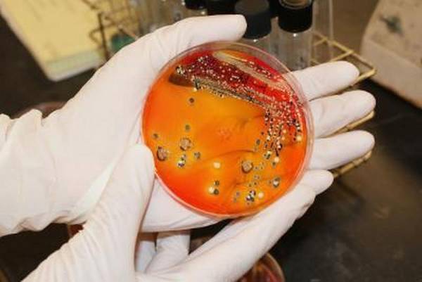 I batteri della Salmonella cresciuti su una piastra in laboratorio (fonte: Università del Missouri)