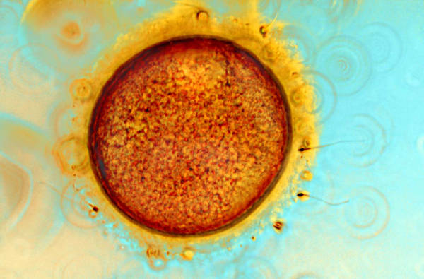 Ovocita umano ed uno spermatozoo che penetra nella zona pellucida (fonte: Spike Walker)