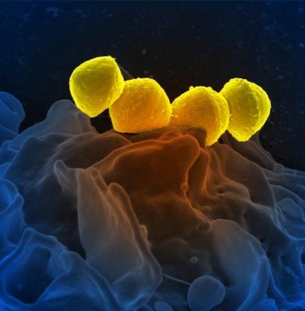 Streptococcus pyogenese visto al microscopio elettronico