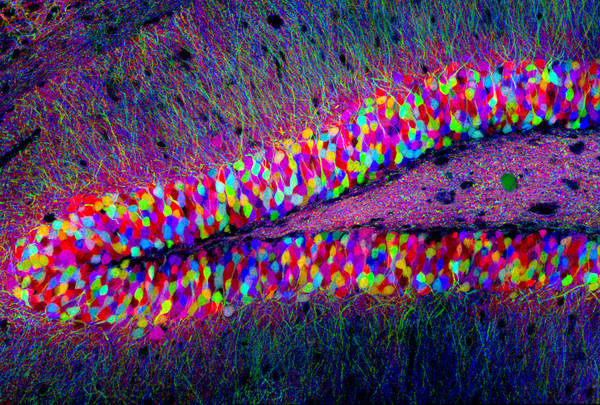 Neuroni di topo (fonte: Tamily Weissman, Harvard University)
