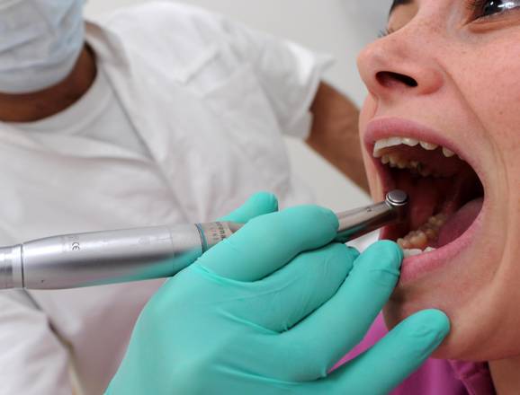 Parlamento Ue chiede stop uso mercurio per cure dentistiche