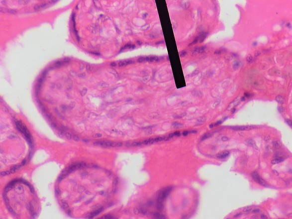 Il tessuto embrionale (mesenchima) da cui hanno origine le cellule staminali 