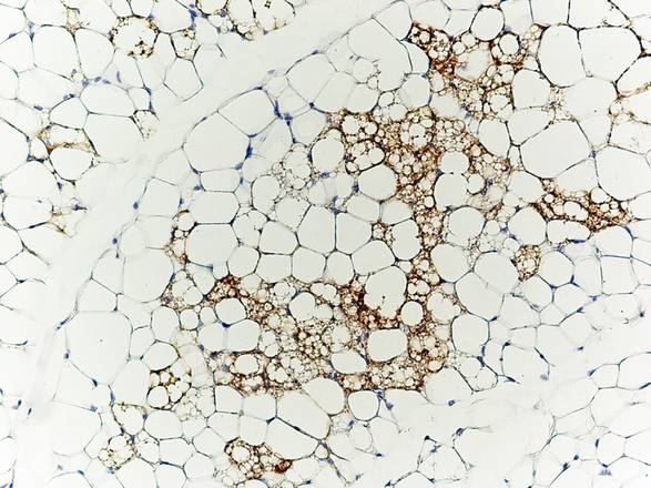 Cellule di tessuto adiposo bruno fra cellule di tessuto bianco (fonte: Patrick Seale, University of Pennsylvania School of Medicine)