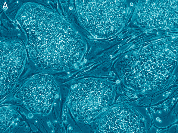 Cellule staminali embrionali umane (fonte: Nissim Benvenisty)