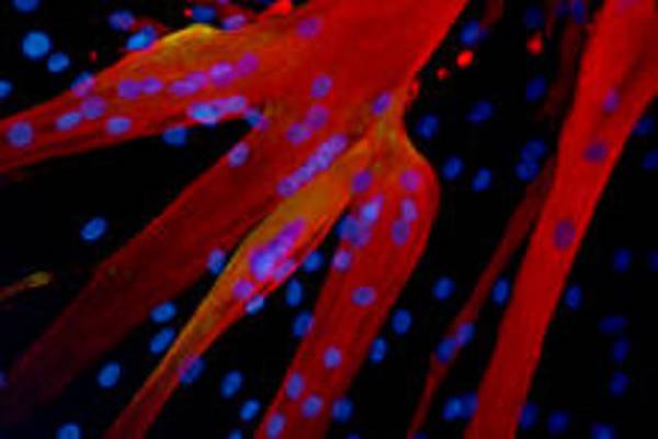 Cellule staminali aiutate da fibre fantasma nella riparazione dei muscoli (fonte: Eurostemcell)