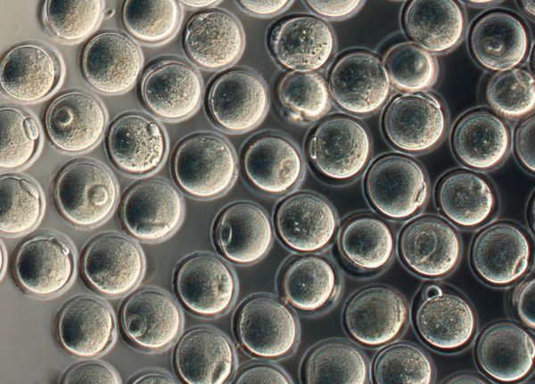 La prima fabbrica di ovuli ottenuta da cellule staminali di topo, (fonte: Orie Hikabe et al, Nature)