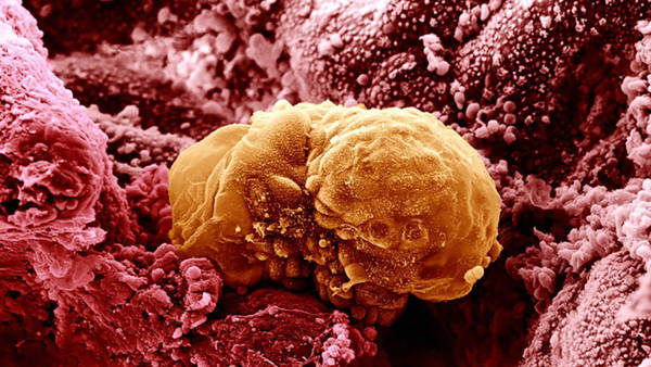 Embrione di 6 giorni (fonte: Yorgos Nikas/Wellcome Images)