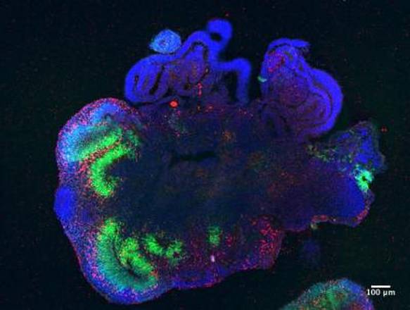 La sezione di un cervello in miniatura, un organoide che aiuta a studiare malattie neurologiche e a sperimentare farmaci (fonte: Madeline Lancaster/MRC-LMB, Medical Research Council, Laboratory of Molecular Biology, UK)