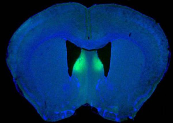 L'interruttore della rabbia identificato nel cervello dei topi (fonte: Current Biology e Cell Press)