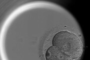 Lo sviluppo naturale di un embrione umano (fonte: Dr Kathy Niakan/Nature)