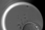 Lo sviluppo di un embrione umano modificato con il taglia-incolla del Dna (fonte: Dr Kathy Niakan/Nature)