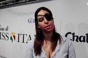Miss Italia, Gessica Notaro: qui contro femminicidio