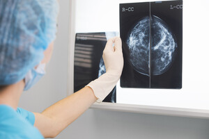 Mammografia spia problemi cuore in menopausa  (ANSA)