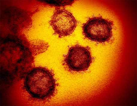 Coronavirus, in 5 immagini il primo ritratto dettagliato © ANSA