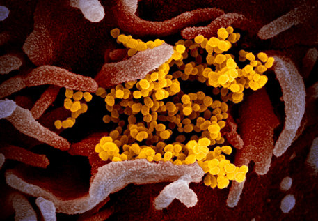 Una delle immagini del coronavirus  (fonte: NIAID-RML) © Ansa