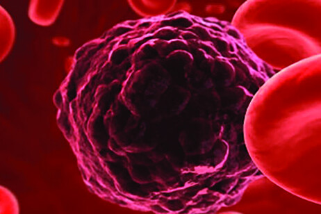 La biopsia liquida che cerca le tracce dei tumori nel sangue diventa più precisa (fonte: ESMO)