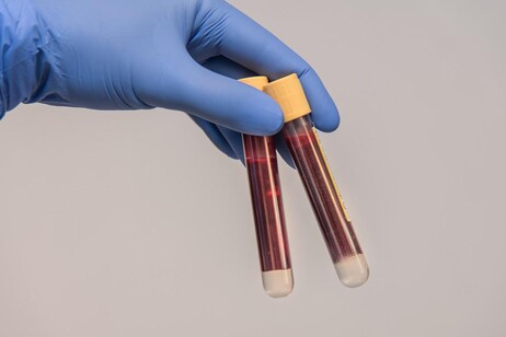 test sangue (fonte: Pixa
