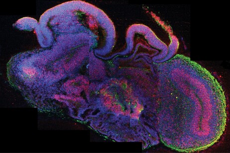 Un organoide cerebrale  (fonte: IMBA/Lancaster via Wikipedia)