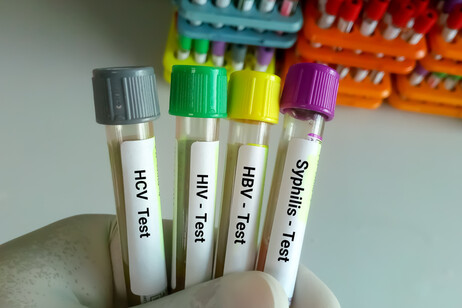 Alcuni test per malattie sessualmente trasmissibili. Sifilide, HBV, HIV, HCV.  Foto: Md Saiful Islam Khan - iStock