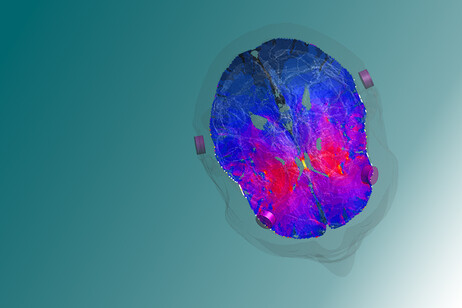 Sperimentata con successo una nuova tecnica di stimolazione cerebrale profonda e non invasiva (fonte: EPFL)