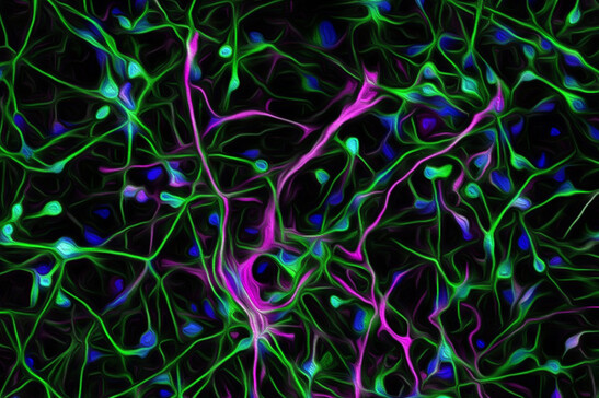 Ingrandimento al microscopio a fluorescenza di neuroni. Le cellule sono state colorate con un marcatore Neuronale (Verde), Gliale (Magenta) ed uno Nucleare (Blu). Fonte IIT